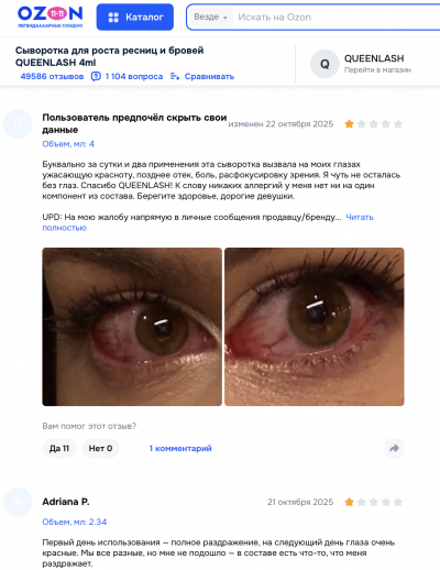Queenlash отзывы: что скрывается за обещаниями роста ресниц?